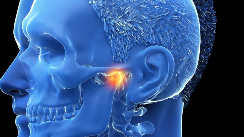 5 Common Myths About TMJ Dysfunction – Debunked!